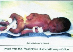 aborted baby girl
